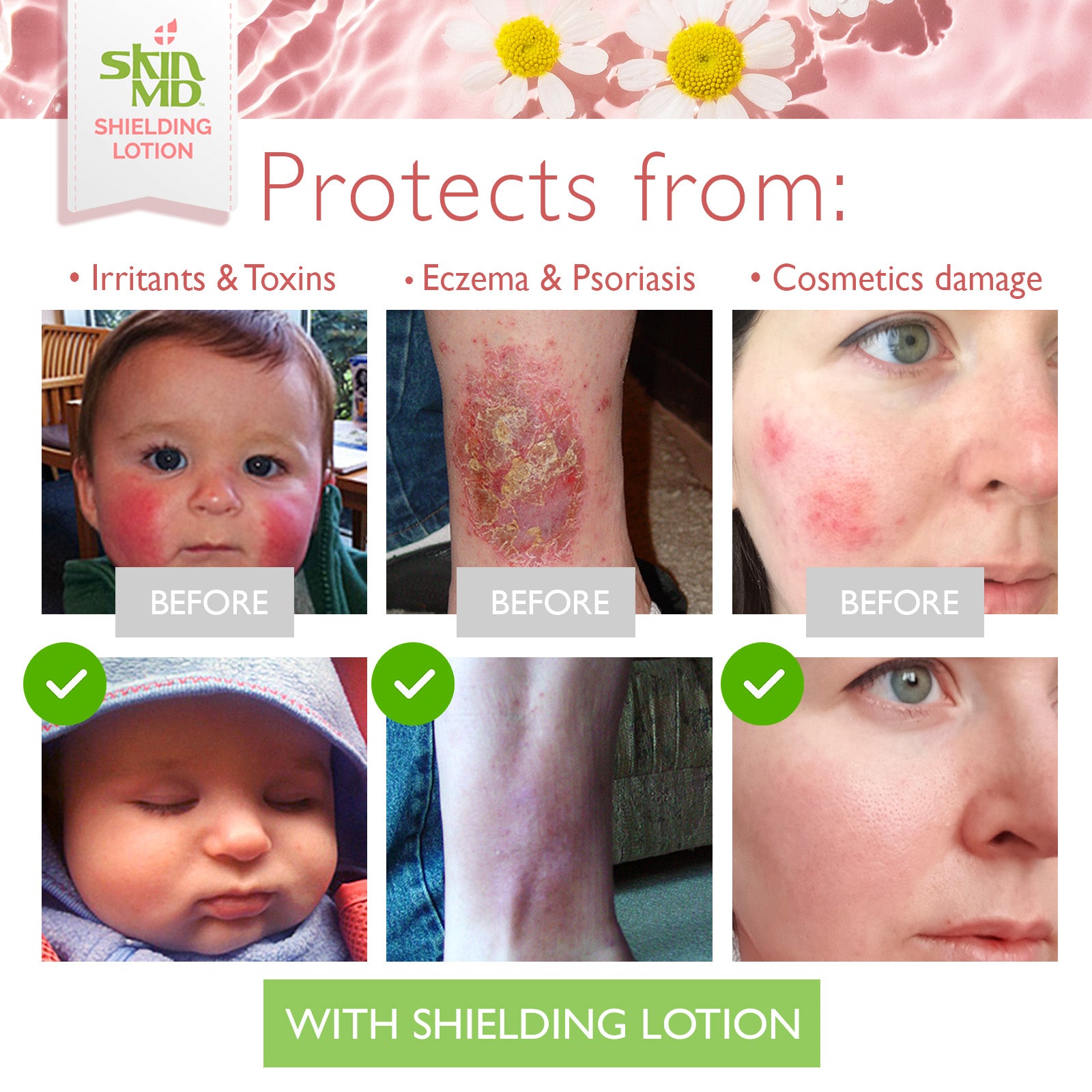Skin MD Shielding Lotion 8oz